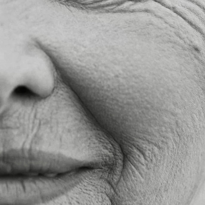 Anti-Aging