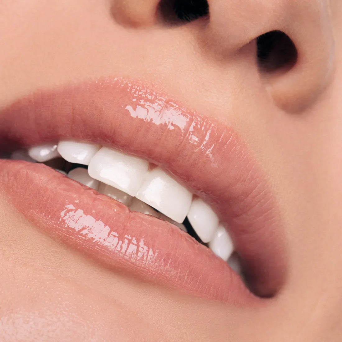 Je lippen in de spotlight